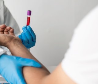 Shutterstock soumissionchimique