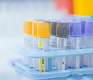 Shutterstock examensbiologiquehorslabo